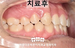 수술후