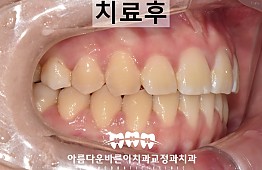 수술후