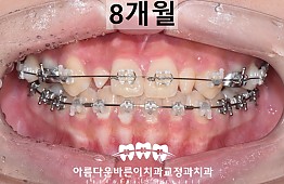 수술후