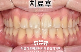 수술후