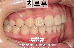 수술후