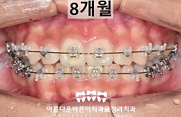 수술후