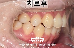 수술후