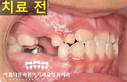 수술전