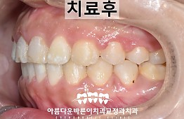 수술후