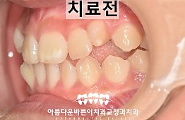 수술전