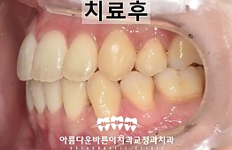 수술후