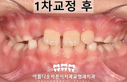 수술후