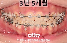 수술후
