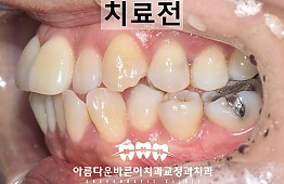 수술전