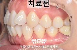 수술전