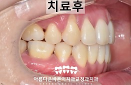 수술후