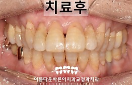 수술후