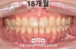 수술후