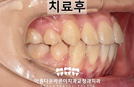 수술후