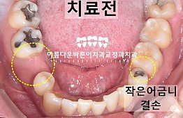 수술전