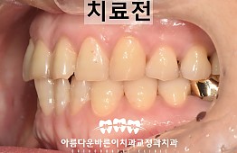 수술전