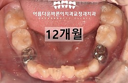 수술후