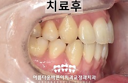 수술후