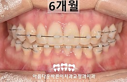 수술후