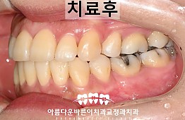 수술후