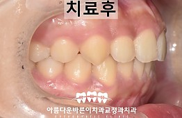 수술후