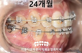 수술후