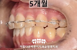 수술후