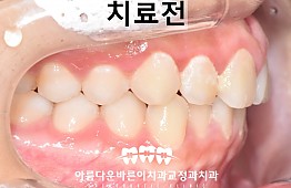 수술전