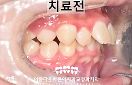 수술전