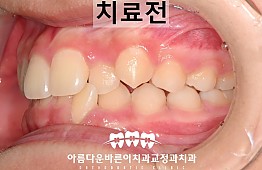 수술전