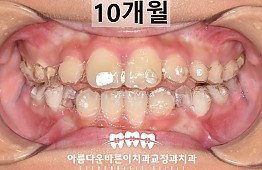 수술후