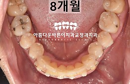 수술후