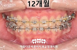 수술후