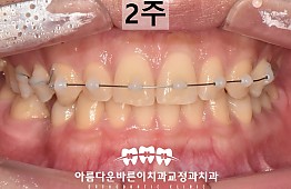 수술후