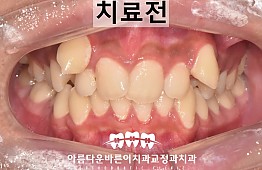 수술전