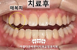 수술후