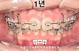 수술후