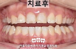 수술후
