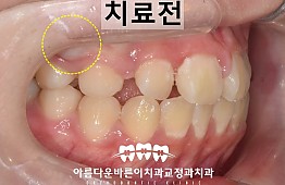 수술전