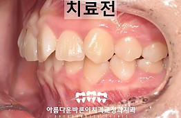 수술전