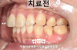 수술전