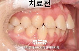 수술전