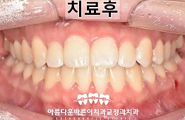 수술후