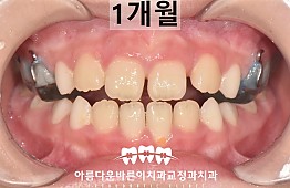 수술후