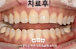 수술후