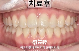 수술후