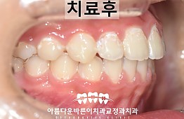 수술후