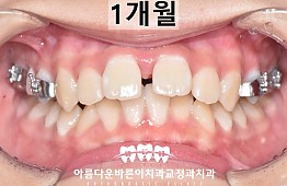 수술후