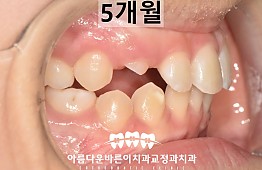 수술후